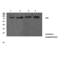 p63 Polyclonal Antibody