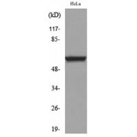 p63 Polyclonal Antibody