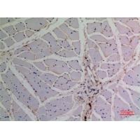 p63 Polyclonal Antibody