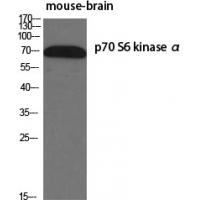 p70 S6 kinase α Polyclonal Antibody