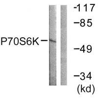 p70 S6 kinase α Polyclonal Antibody