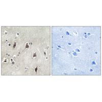 p70 S6 kinase α Polyclonal Antibody