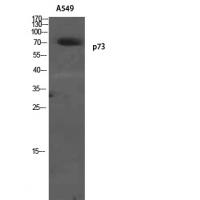 p73 Polyclonal Antibody