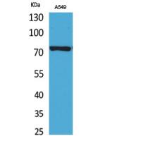 p73 Polyclonal Antibody