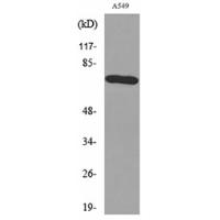 p73 Polyclonal Antibody