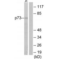 p73 Polyclonal Antibody