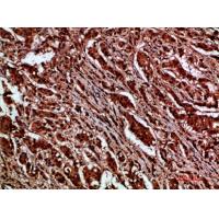 p120 Polyclonal Antibody