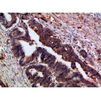 p120 Polyclonal Antibody