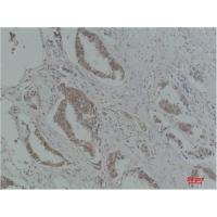 p21 Polyclonal Antibody