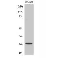 p27 Polyclonal Antibody