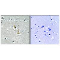 p47-phox Polyclonal Antibody