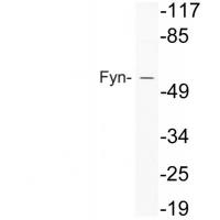 Fyn Polyclonal Antibody