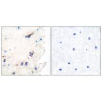 PLC β3 Polyclonal Antibody