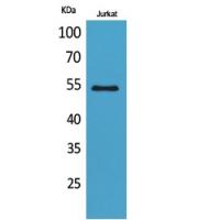 MMP-12 Polyclonal Antibody