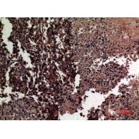 MMP-12 Polyclonal Antibody