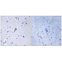 mTOR Polyclonal Antibody