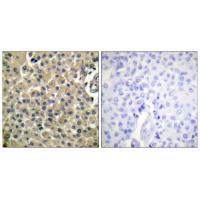 Mucin 1 Polyclonal Antibody