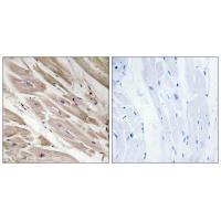 MYBPC3 Polyclonal Antibody