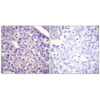 MYPT1 Polyclonal Antibody