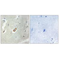 Cdc16 Polyclonal Antibody