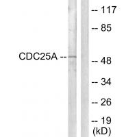 Cdc25A Polyclonal Antibody