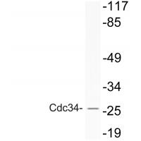 Cdc34 Polyclonal Antibody