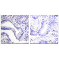 Cleaved-Caspase-7 p20 D198 Polyclonal Antibody