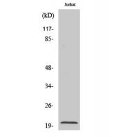 Cleaved-Caspase-7 p20 D198 Polyclonal Antibody