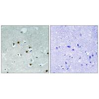 HP1-α Polyclonal Antibody