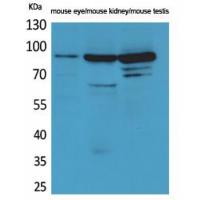 Hrs Polyclonal Antibody