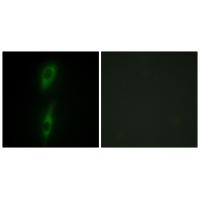 ALK-1 Polyclonal Antibody