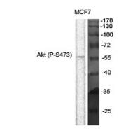 Akt phospho Ser473 Polyclonal Antibody