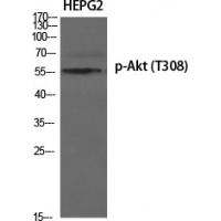 Akt phospho Thr308 Polyclonal Antibody