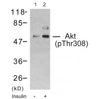 Akt phospho Thr308 Polyclonal Antibody