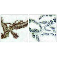 Akt phospho Thr308 Polyclonal Antibody