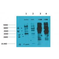 Phospho tyrosine Monoclonal Antibody2C1