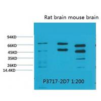 Phosphoserine Monoclonal Antibody5B12