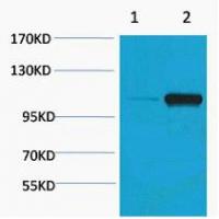 PEPC Phospho Ser15 Polyclonal Antibody