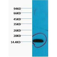 Histone H3 Tri Methyl Lys79 Monoclonal Antibody5D8