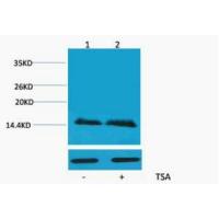 Histone H2B Acetyl Lys5 Polyclonal Antibody