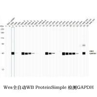 GAPDH Monoclonal Antibody