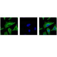 β-tubulin Monoclonal Antibody