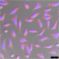 β-actin Polyclonal Antibody