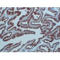 N-cadherin Monoclonal Antibody PT0199