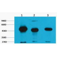 FH Fumarase Monoclonal Antibody2B11