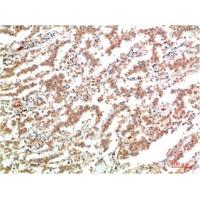 JAK2 Mouse Monoclonal Antibody3F10