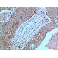 JAK2 Mouse Monoclonal Antibody3F10