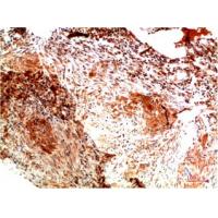 Collagen II Mouse Monoclonal Antibody1H1