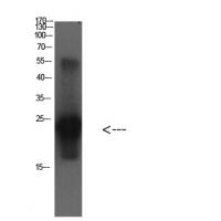 Cystatin C Mouse Monoclonal Antibody3B12