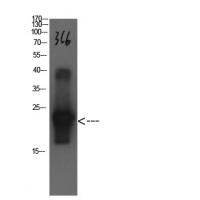 Cystatin C Mouse Monoclonal Antibody3C6